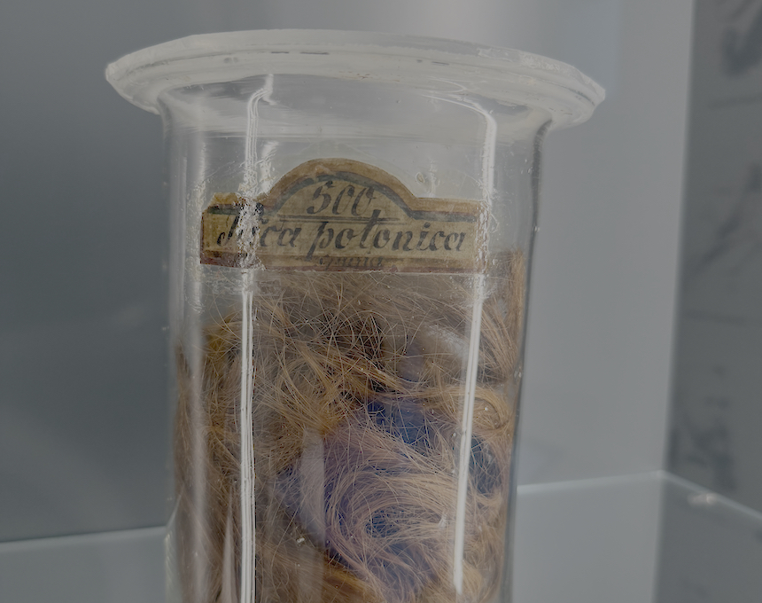 Fotografia przedstawiająca Kołtun polski w Muzeum Patologiczno-Anatomicznym w Wiedniu